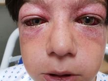 The g-force pushed blood into Tyler's head which caused him to pass out, his mum said