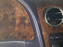 Done gap normal / gone 