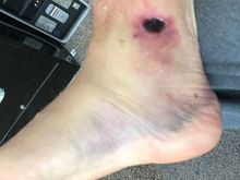 This was five days post incident.