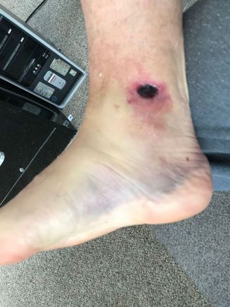 This was five days post incident.
