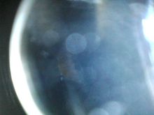 This picture sow both intake valves. The other valve seat appears to still be in place.
